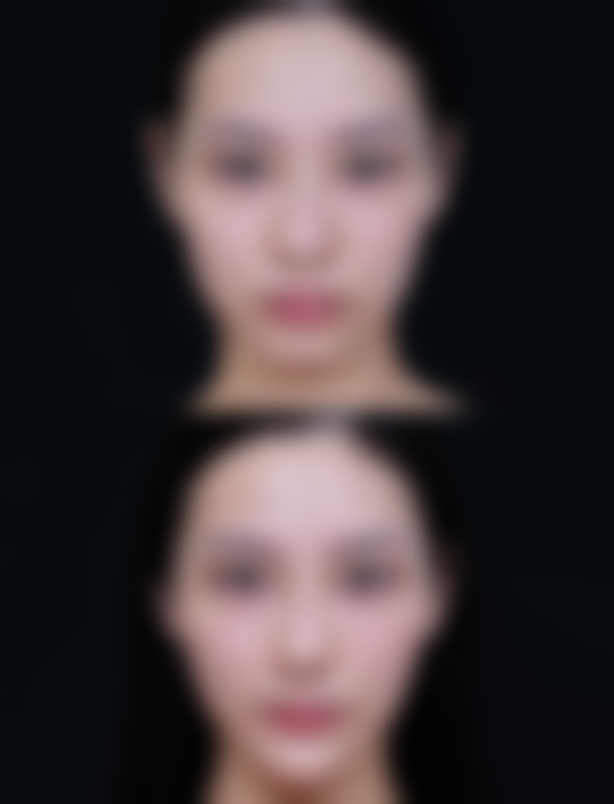 九、邯郸莱媚俪美容整形真实的患者评价