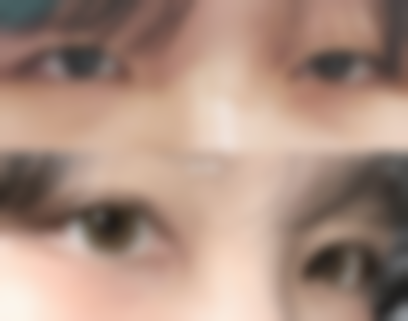 五、日本Ritz（广比利次）美容外科医院价格表