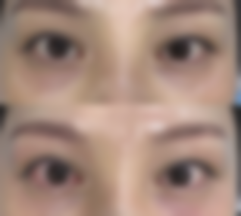 二、日本Ritz（广比利次）美容外科医院怎么样？