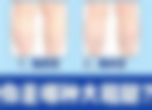 五、去除脸部色素疤痕的注意事项