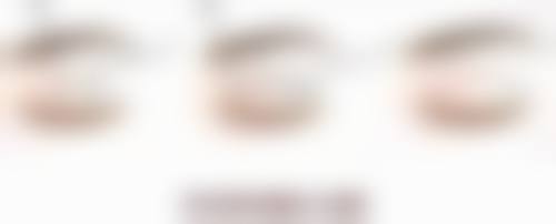 三、切眼袋手术的其他潜在风险