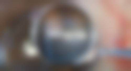 五、怎么判断外伤后疤痕的修复情况