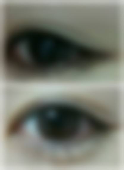 三、长春艾尔莎医疗美容诊疗项目有哪些?