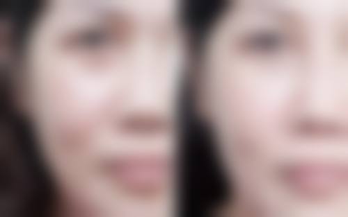 二、东莞雅乔整形医院怎么样?