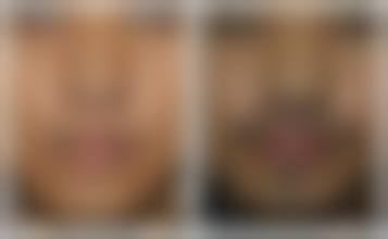 四、厦门欣颜时光医美特色项目