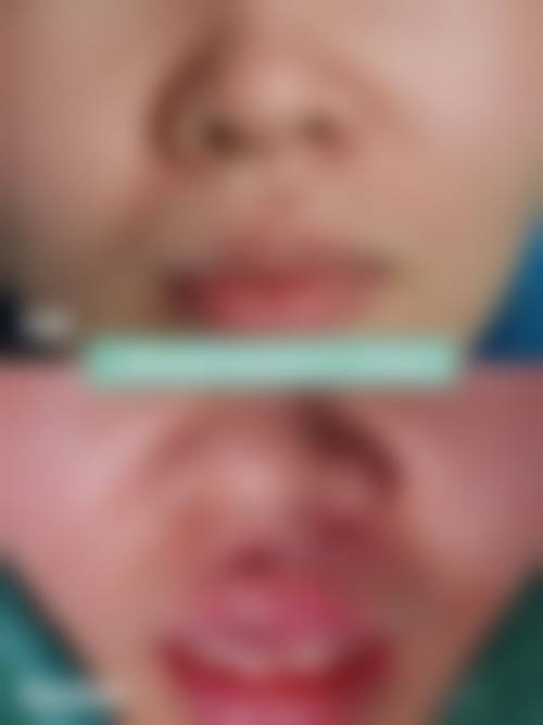 五、西藏丽奥整形医院价格表