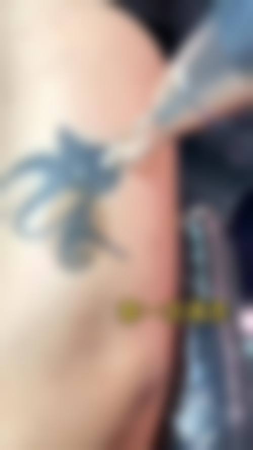 二、中日友好医院西区怎么样?