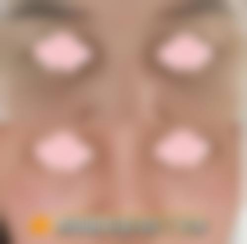 一、清远清城韩美医疗美容门诊正规吗?