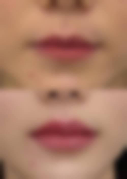 五、新疆阳光天使整形医院价格表