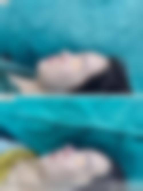 四、深圳璧丽维纳医疗美容医院特色项目