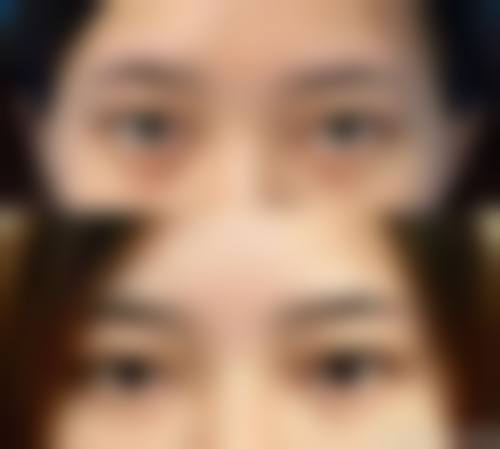 二、新疆阳光天使整形医院怎么样？