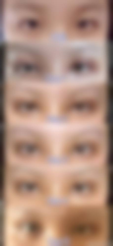 六、厦门欣颜时光医美价格表