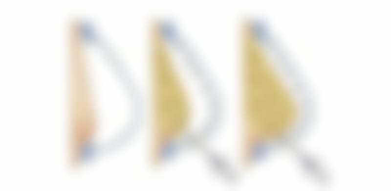 四、何明达收费价格表