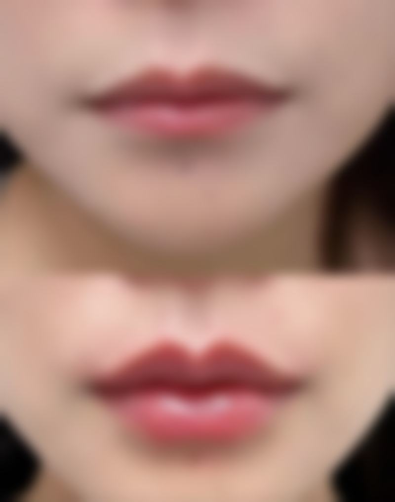 三、不同激光类型的作用对比