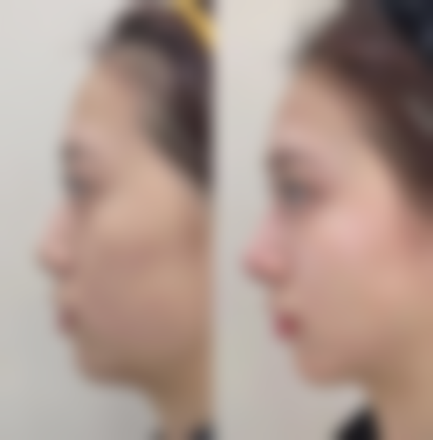 八、清远清城韩美医疗美容门诊预约方式