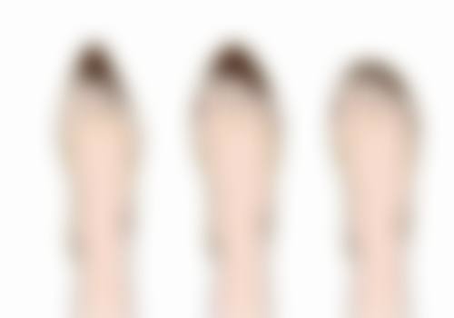 五、能不能只割一个双眼皮之手术注意事项