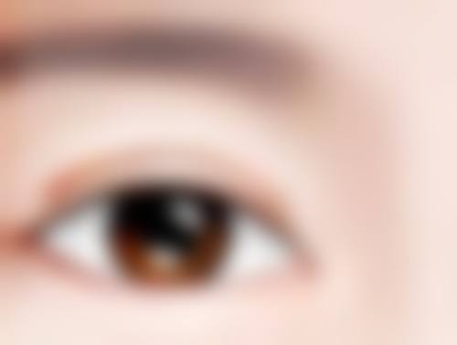 二、能不能只割一个双眼皮之手术风险揭示