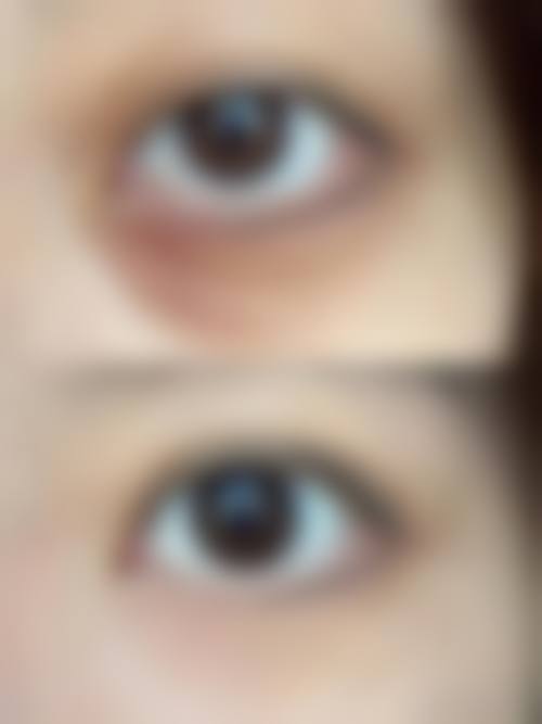 八、모우림의원真实的患者评价