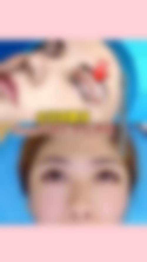 四、呼和浩特华美整形特色项目