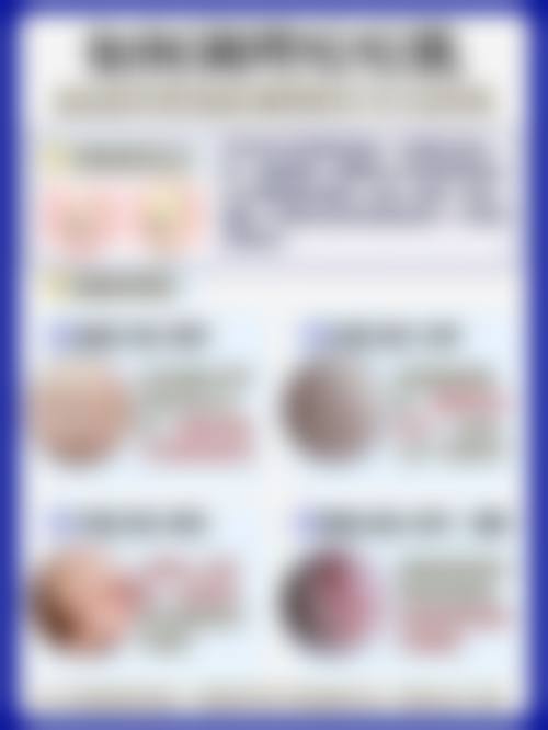 三、夏厚林技术优势