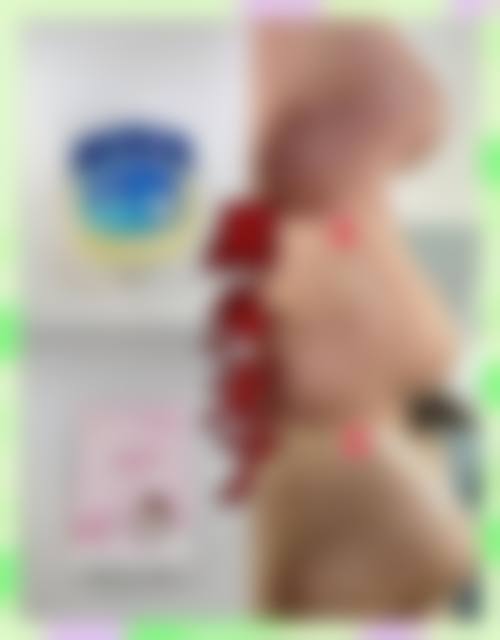 八、北京爱颜医疗美容真实的患者评价