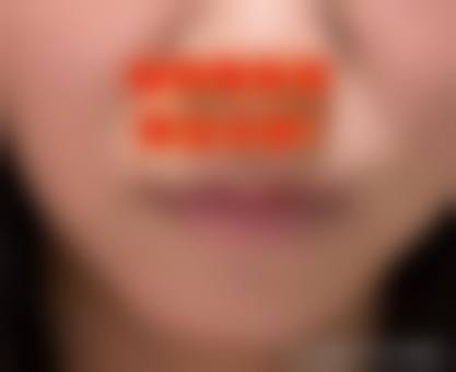 四、成都轻安美育医疗美容诊所特色项目