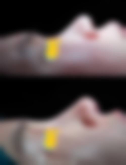 五、成都轻安美育医疗美容诊所价格表