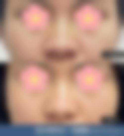 二、宫崎Lily诊所怎么样？