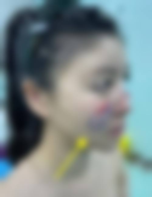 六、上海迪蔻整形医院价格表