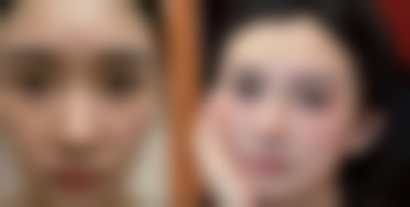 眼膜可以缓解眼袋吗？了解不同类型眼袋，探寻眼膜缓解效果及针对性方案 