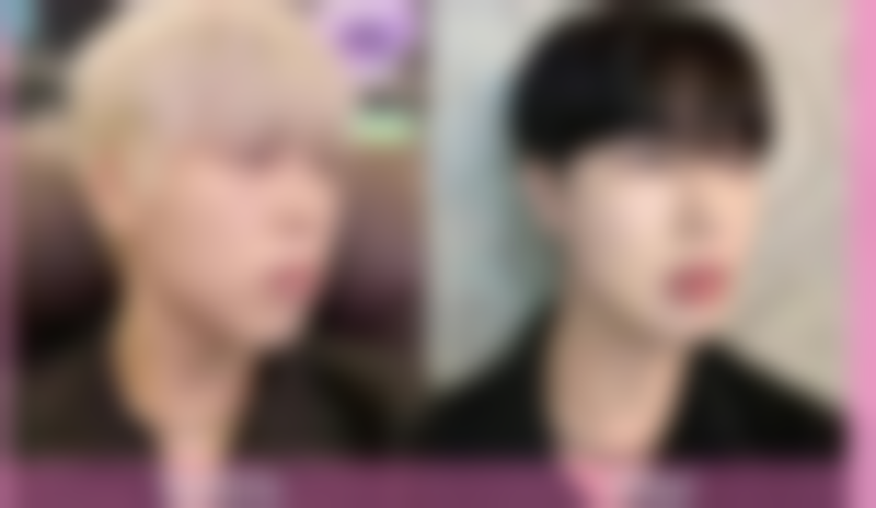 二、影响瘦脸针成效的关键因素