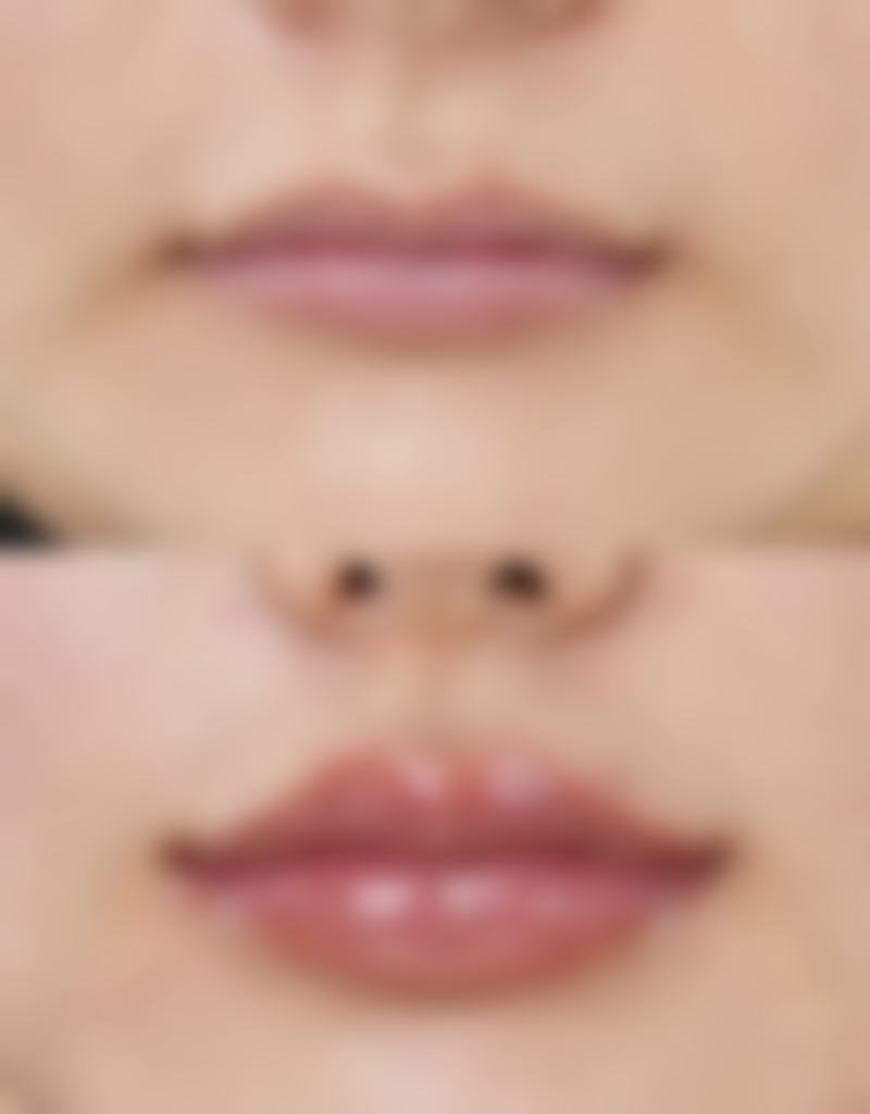 六、治疗期间的注意事项