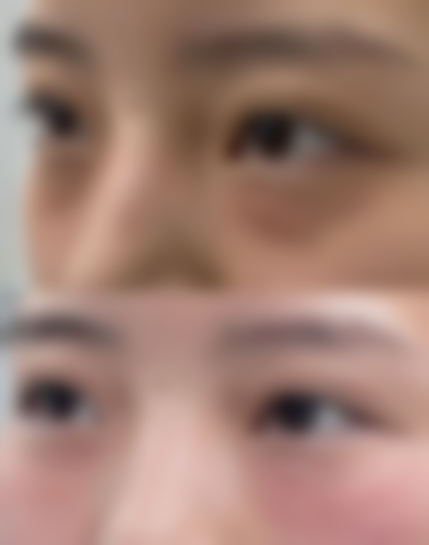 三、北京爱颜医疗美容诊疗项目有哪些?