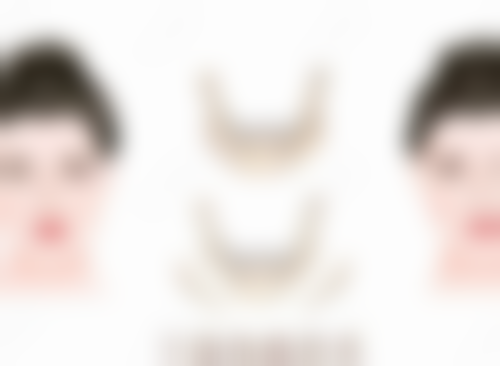 三、治疗选择的关键建议