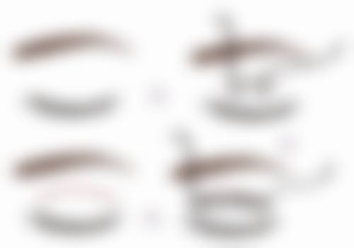 四、张家界瑞美整形医院特色项目