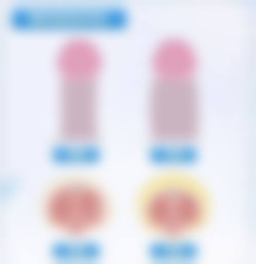 二、硅胶隆鼻的优缺点及适用人群