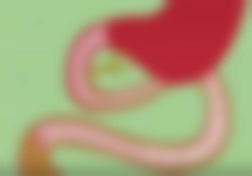 一、了解眼袋形成原因,为去眼袋打基础