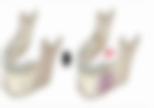 八、杭州奕彩兰香整形医院真实的患者评价