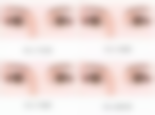 四、频繁注射除皱针引发的其他问题