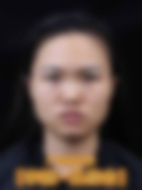 六、韩国nplus整形外科价格表