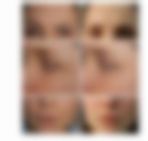 四、韩国nplus整形外科特色项目