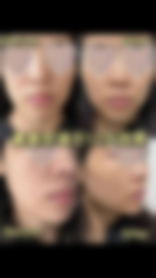 郑州金水秋涛医疗美容诊所价格表