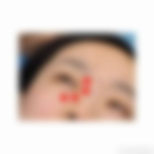 二、日本乳房再建医院怎么样？