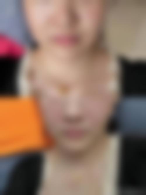 九、遵义曾斌整形医院真实的患者评价