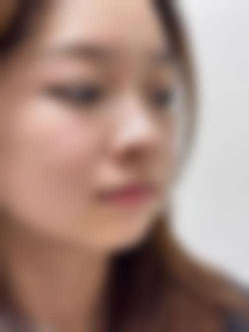 八、海口依琳医疗美容门诊部真实的患者评价