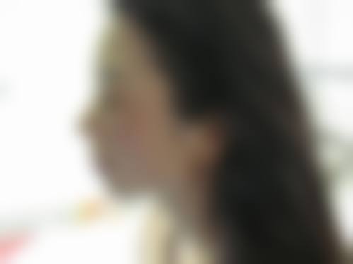 四、杭州奕彩兰香整形医院特色项目