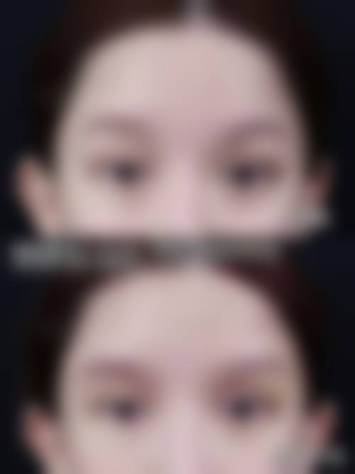 三、深圳韩秀玉颜整形医院诊疗项目有哪些？