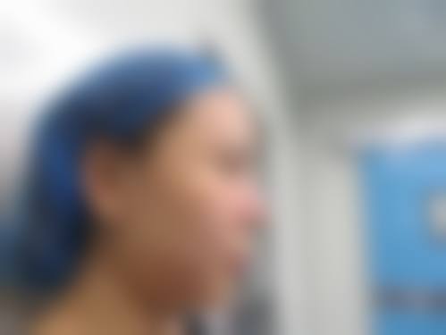 五、深圳韩秀玉颜整形医院价格表