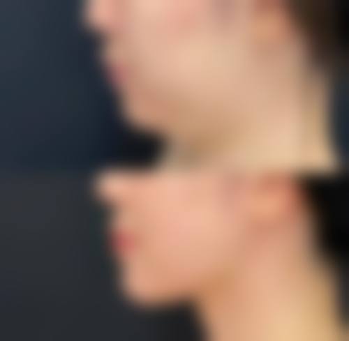 二、浙江杭州瑞丽整形(玉古路店)怎么样?