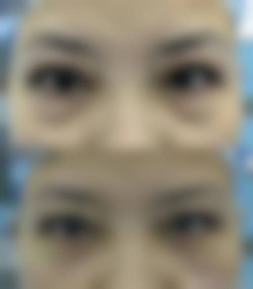 四、深圳享美瑞尼丝医疗美容特色项目